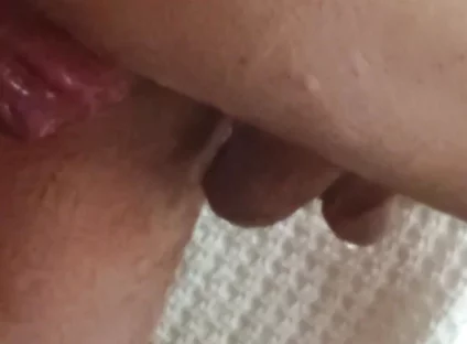 Prolapse and Urine