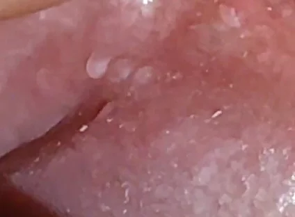 Super Daddy Enlarged Hole Pulsing with Horniness.