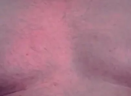 Brust Raus Nippel