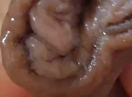 Large Foreskin and Balls in Striking Close-up.